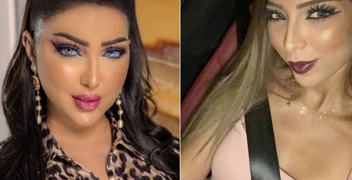 نجمات بالغن في عمليات التجميل وأفسدن شكلهن