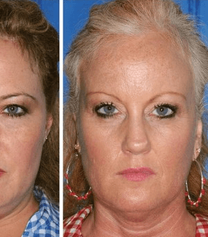 مقارنة بين أخت مدخنة وأخت غير مدخنة