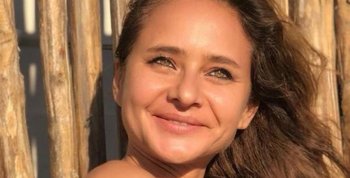 الرؤوس السوداء في الوجه 