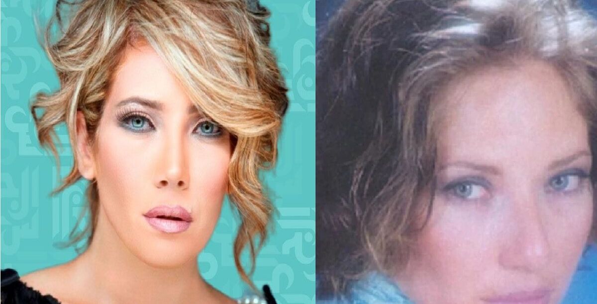 ممثلات سوريات قبل وبعد التجميل