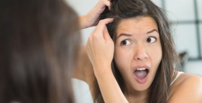علاج القشره من اول مره بهذه الخلطات