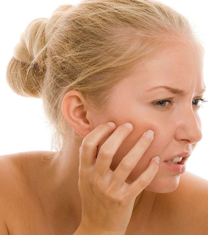 طرق التخلص من اثار حب الشباب | ازالة آثار الحبوب طبيعياً في المنزل