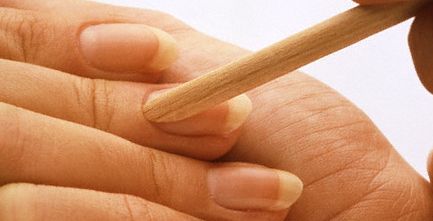 الجلد الميت حول الأظافر