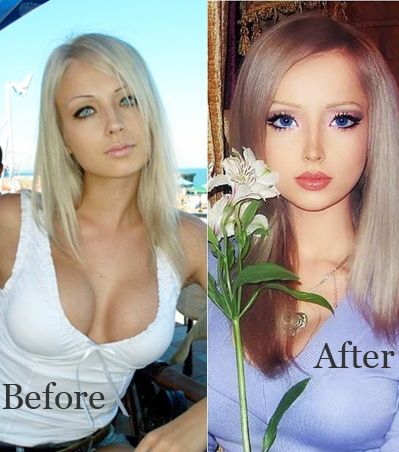 فاليريا لوكيانوفا قبل وبعد عمليات التجميل