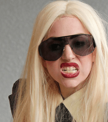 lady-gaga-hair-loss-23-3-2011