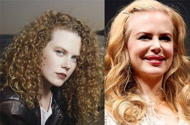 الفنانات قبل وبعد التجميل | عمليّات تجميل فاشلة للفنانات