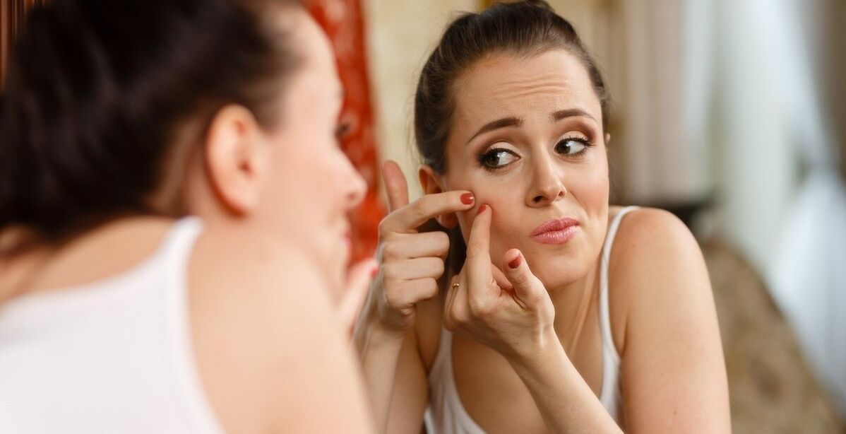 ابرة الرؤوس السوداءت
