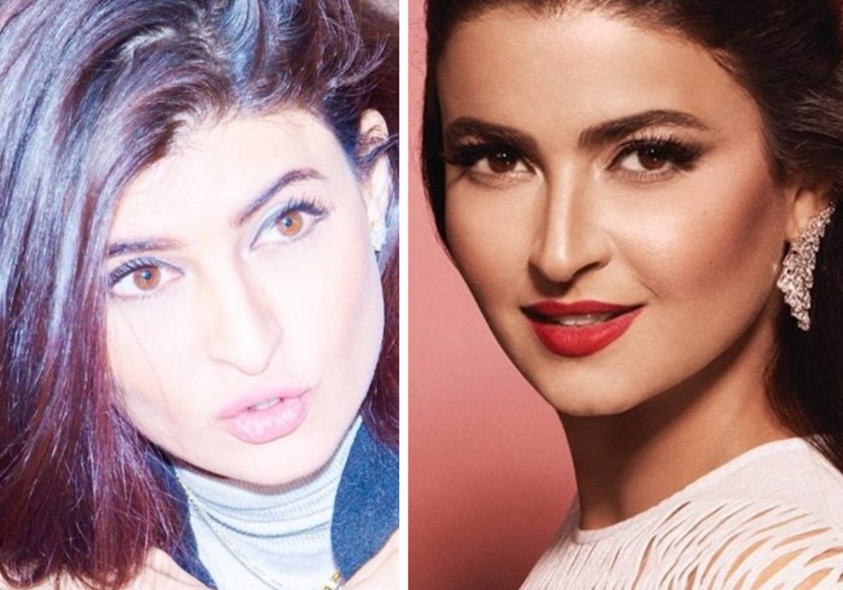 علا الفارس قبل التجميل وبعده