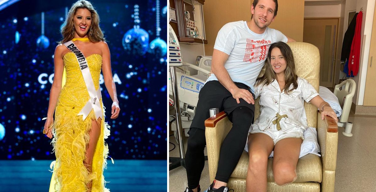 ملكة جمال كولومبيا تبتر ساقها لتتمكن من الرقص والركض