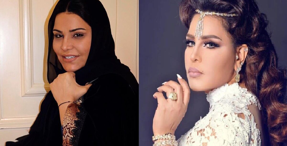 حقن البلازما للوجه قبل وبعد
