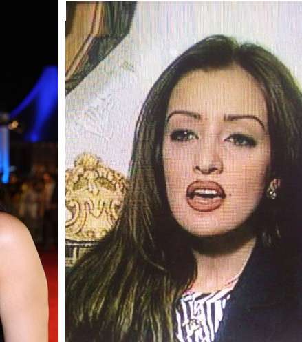 صور ميساء مغربي قبل التجميل | ميساء مغربي قبل وبعد عمليات التجميل