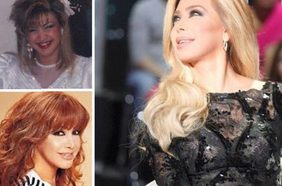 صور اسنان النجمات العربيات قبل التجميل