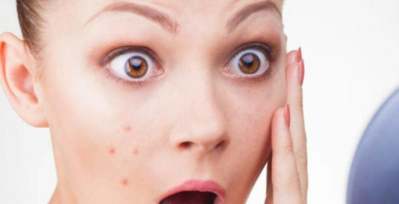 كيفيّة التخلّص من حبوب البشرة