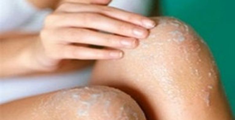 خلطة تبييض الركب في المنزل