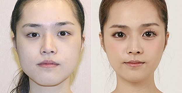 عمليات التجميل الغريبة تجتاح كوريا!