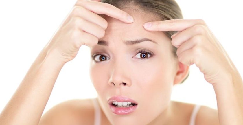 طرق علاج اثار الحبوب