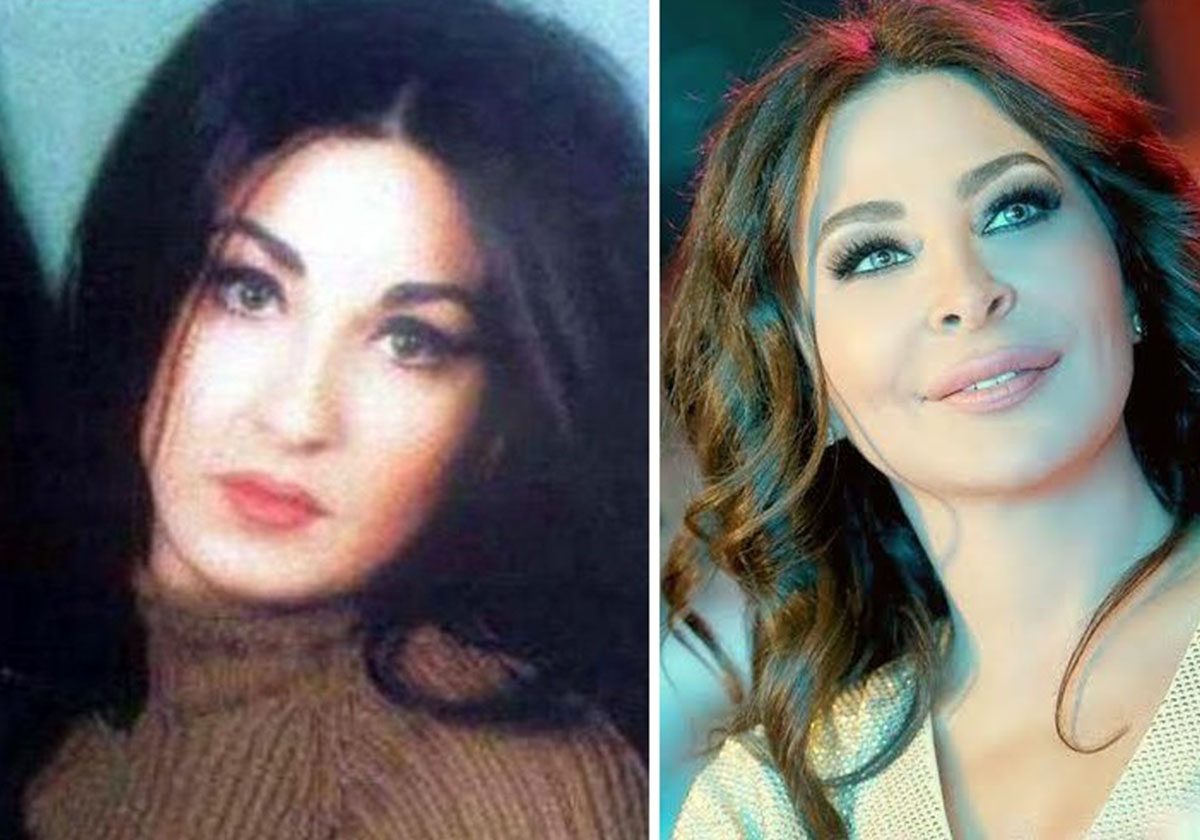 اليسا قبل التجميل وبعده