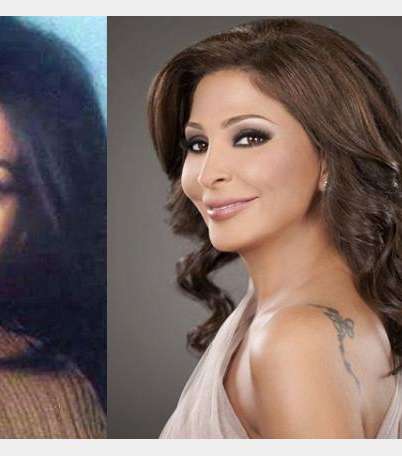 اليسا قبل عمليّات التجميل
