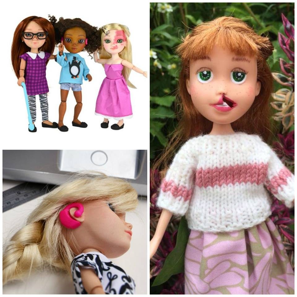 دمى بتشوهات خلقية