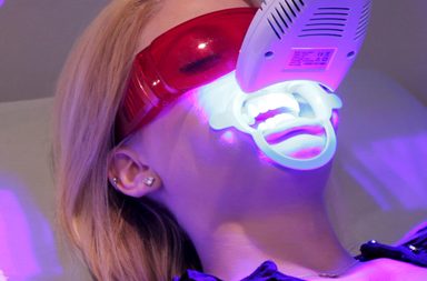 مخاطر واضرار تبييض الاسنان بالليزر