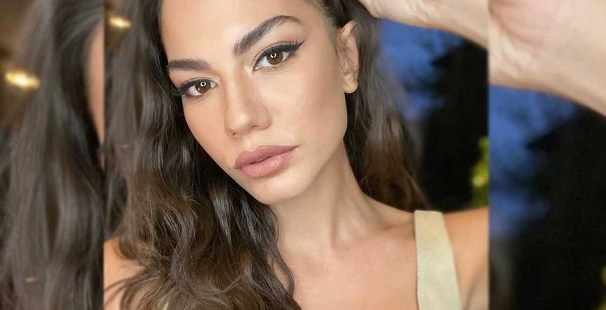 شوائب جمالية تعاني منها النجمات
