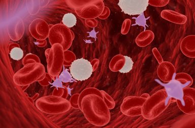 هل سرطان الدم خطير