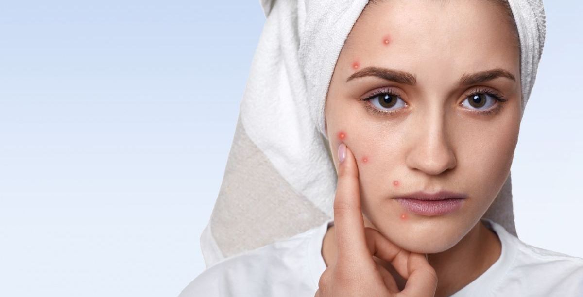 علاج الحبوب الحمراء الملتهبة