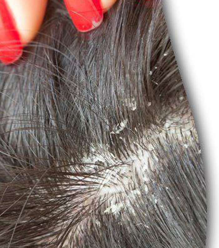 فوائد زيت الصبار للشعر