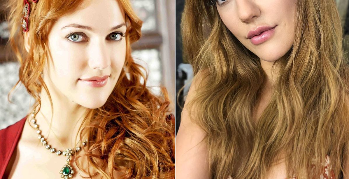 تعرفي إلى عمليات التجميل التي أجرتها مريم أوزرلي!