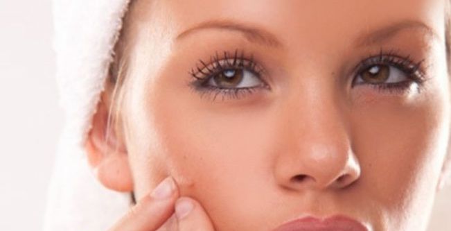 الرؤوس السوداء وحبّ الشباب