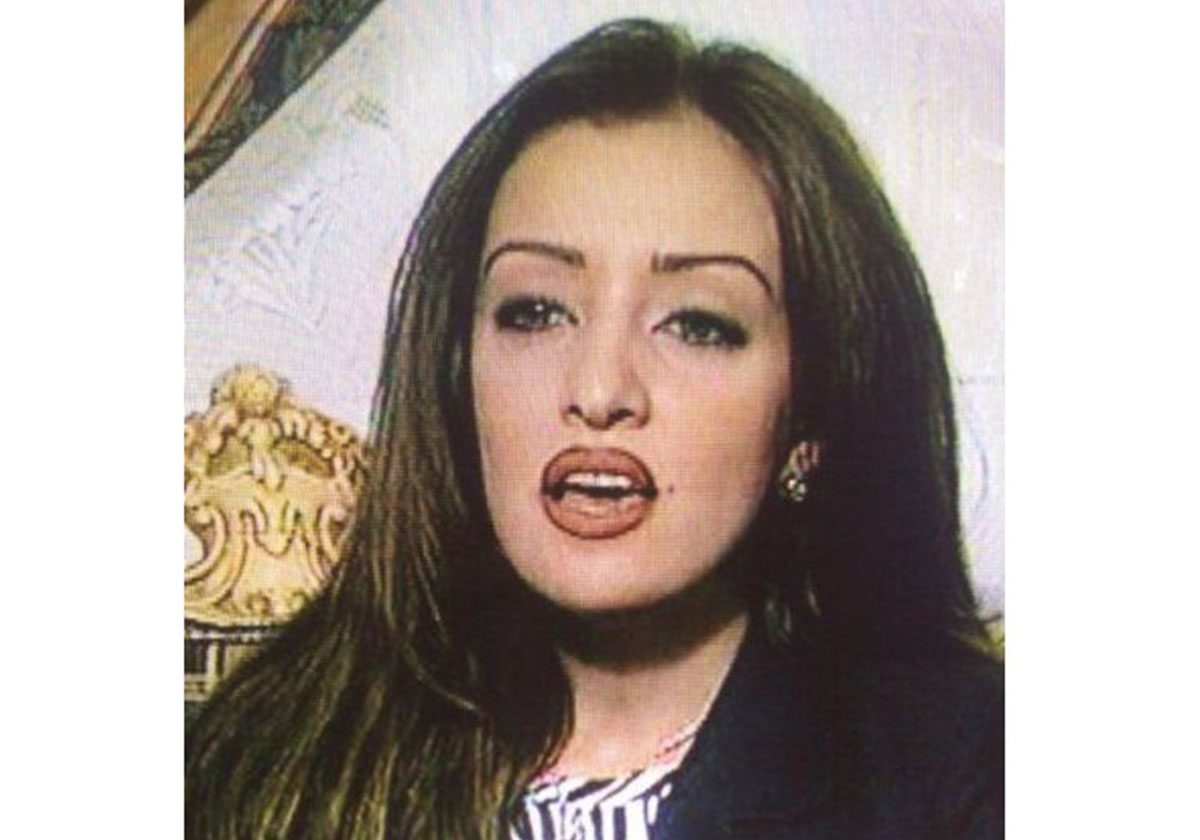 ميساء مغربي وصورة صادمة لها قبل التجميل