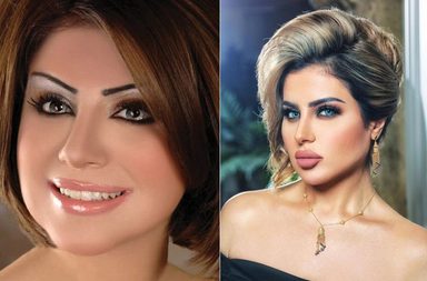  نجمات الخليج قبل فيلر الشفاه وبعده: صور تظهر الفرق المذهل