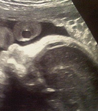 صور: جيرارد بيكيه يستغل شاكيرا الحامل على تويتر