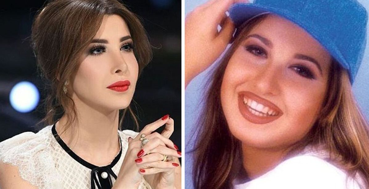 عمليات تجميل كانت ضرورية للنجمات...والصور تؤكد ذلك!