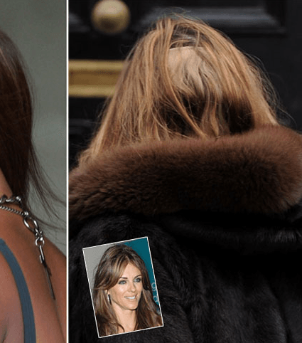 Naomi Campbell-Elizabeth-Hurley-hair-loss-23-3-2011