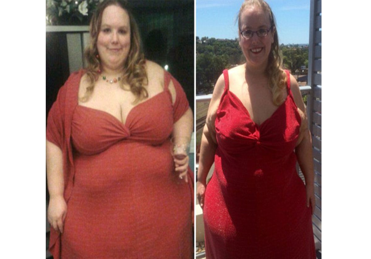 قضت فرجينيا ليلة زفافها في المستشفى وخسرت 157 كيلوغراماً من وزنها!‏