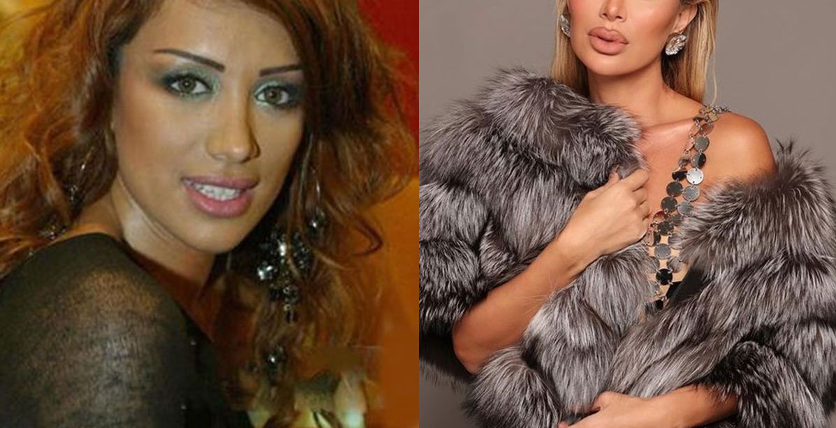 مايا دياب قبل وبعد التجميل