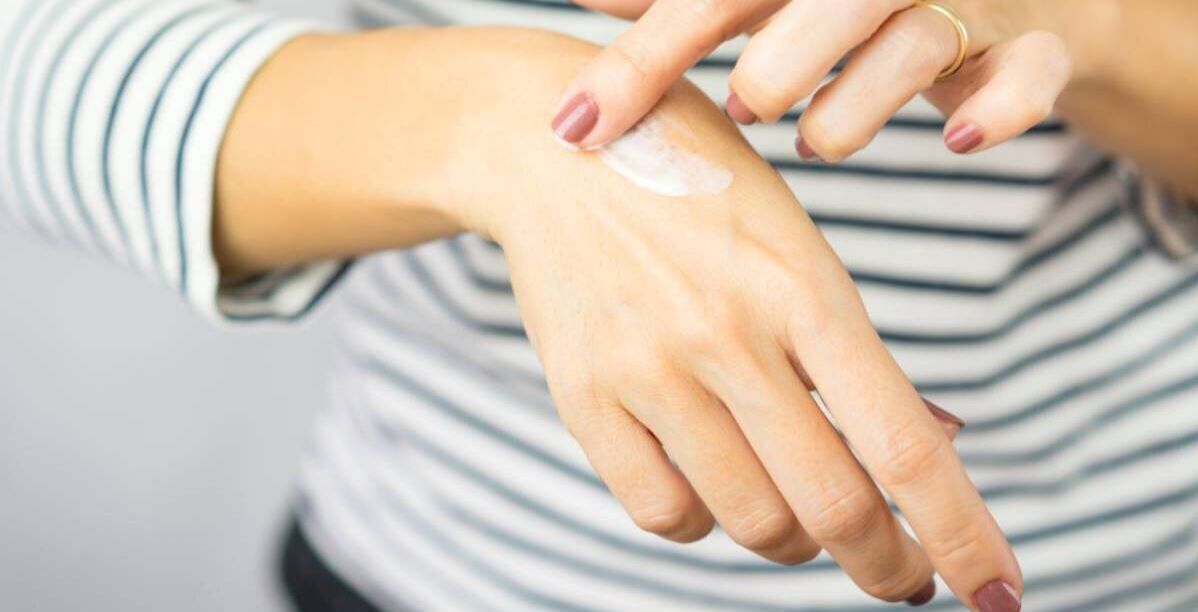 علاج الحروق بخلطات طبيعية