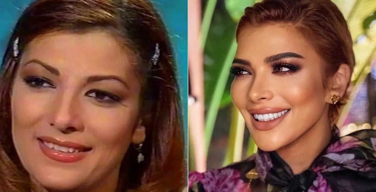 النجمات قبل وبعد الهوليوود سمايل
