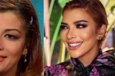 النجمات قبل وبعد الهوليوود سمايل