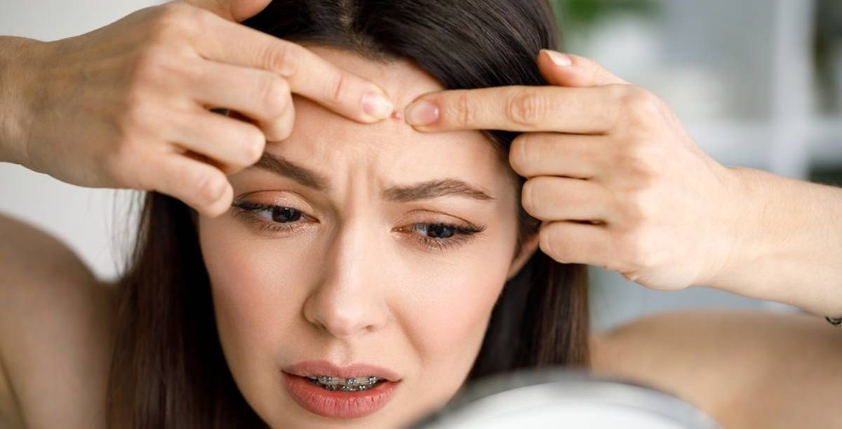 طريقة علاج حبوب الجبين