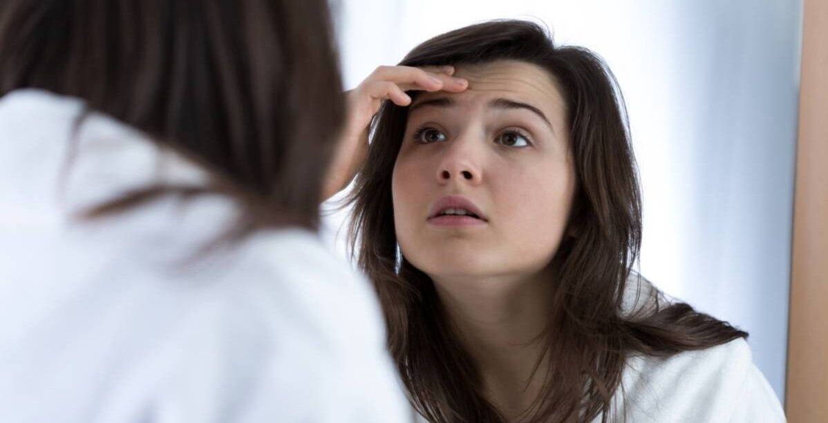 خلطات لعلاج الحبوب والبثور
