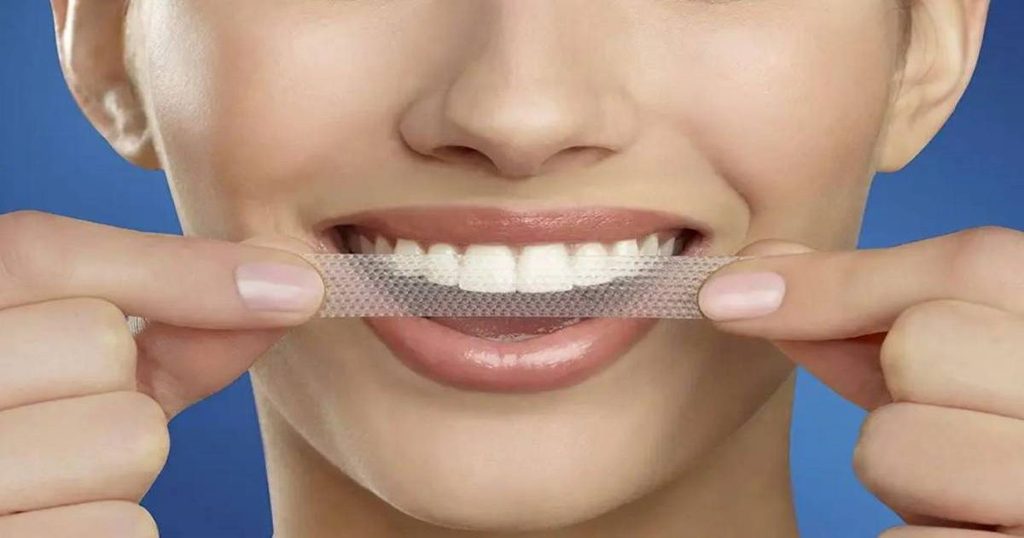 تقنيات تبييض الأسنان