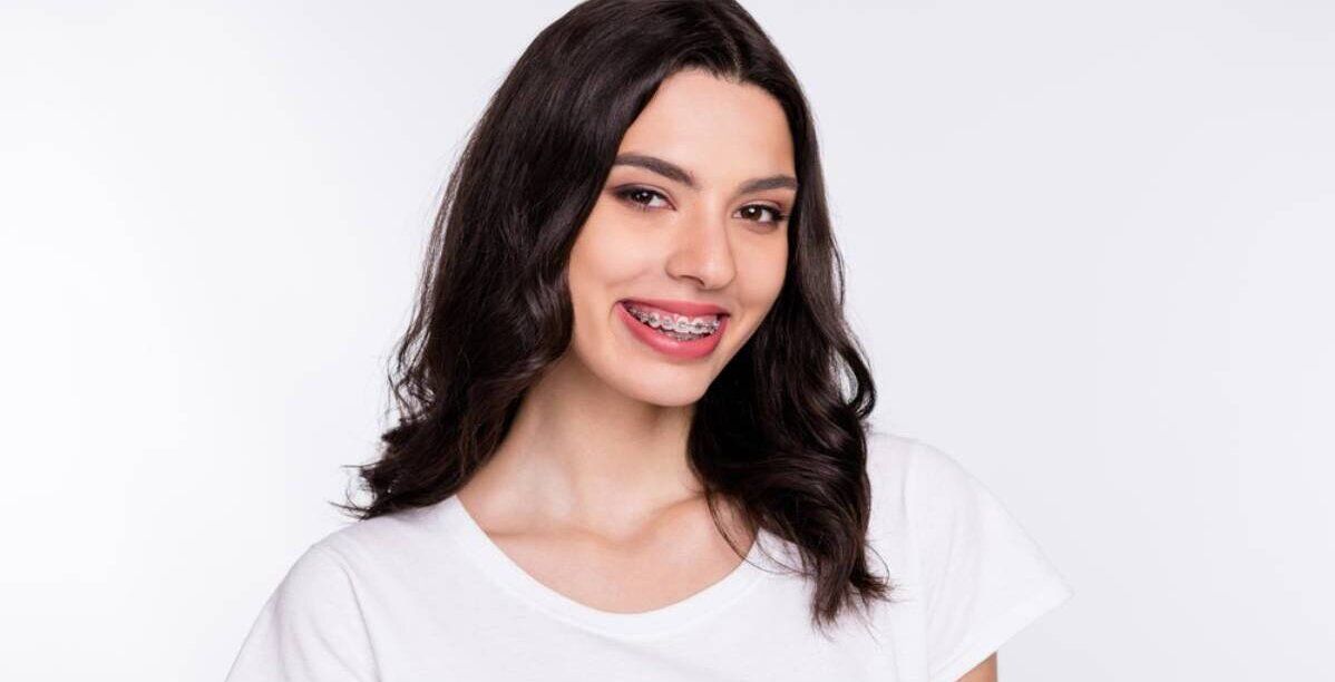 أنواع تقويم الأسنان