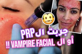 بالفيديو، زينة تجرب تقنية أبر النضارة للعناية بالبشرة