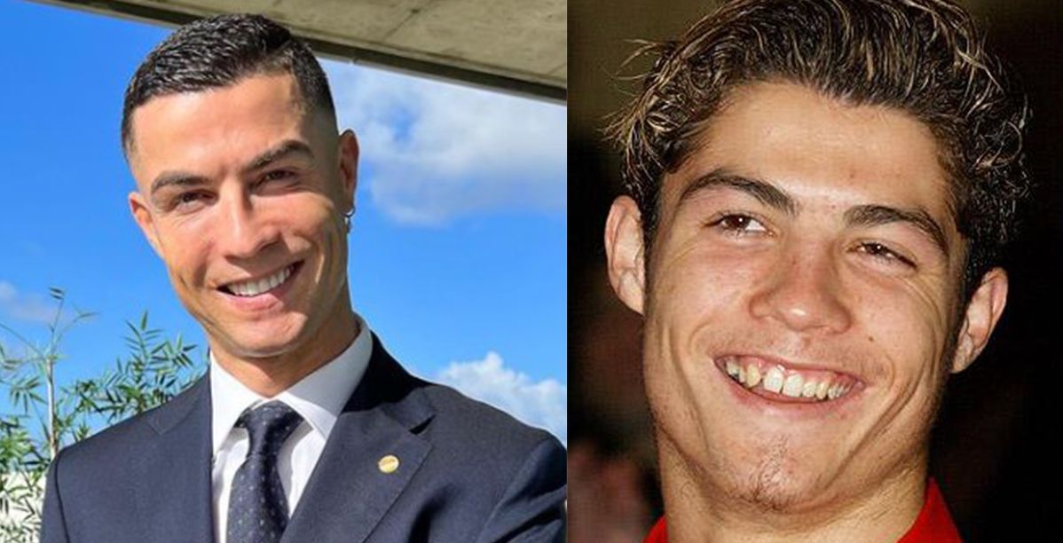 كريستيانو رونالدو قبل وبعد