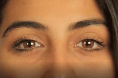 بالفيديو، كيفيّة معالجة الهالات السّوداء