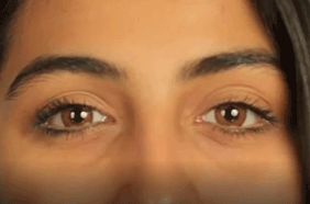 بالفيديو، كيفيّة معالجة الهالات السّوداء