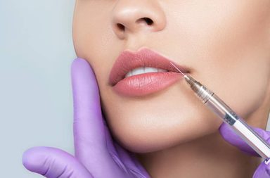 اضرار الفيلر للشفايف