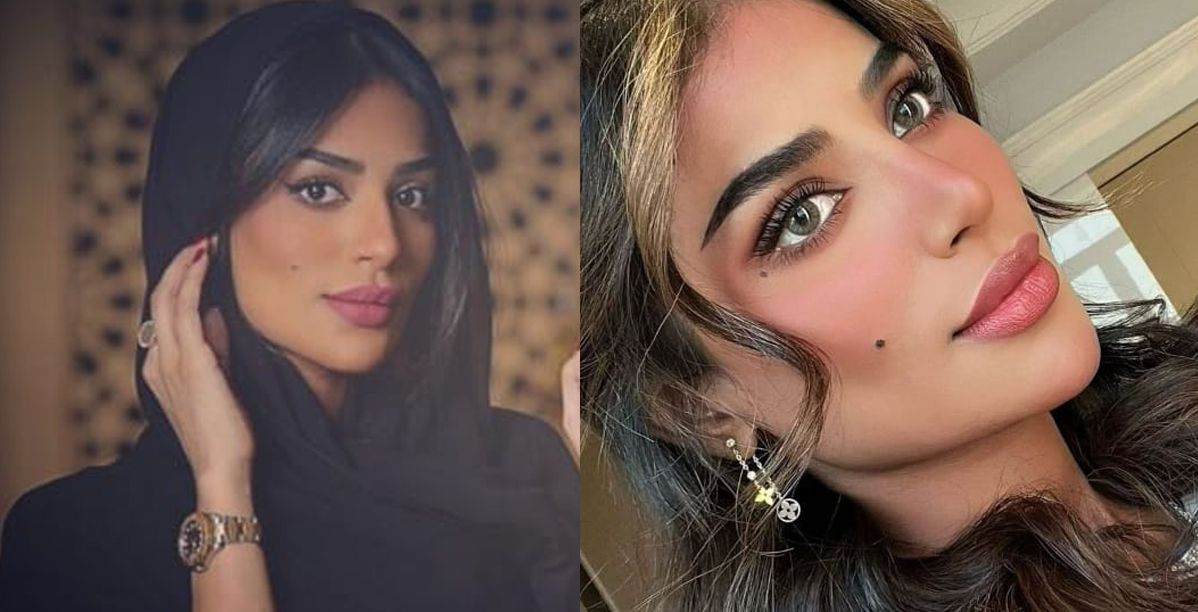بلوغرز سعوديات خضعن لتذويب الفيلر وأصبحن أجمل بكثير